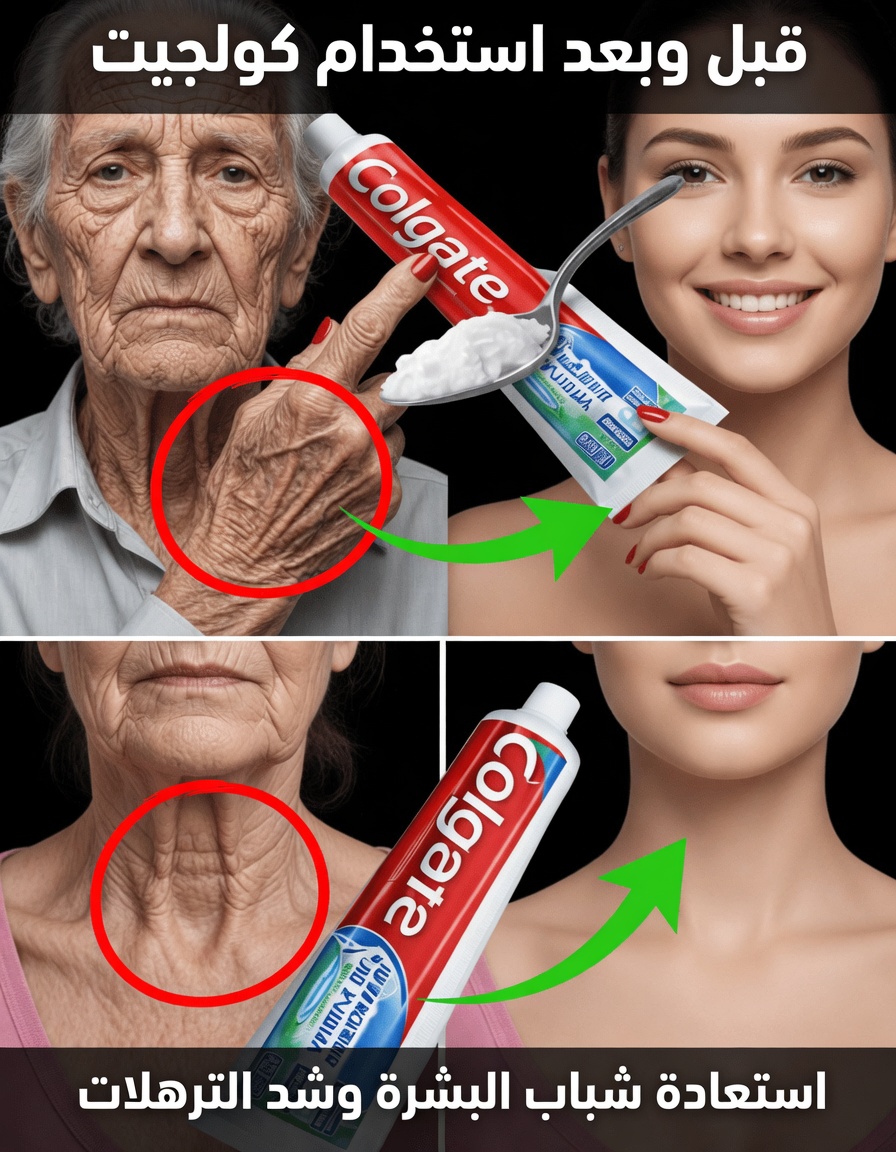 لماذا لا يُعدّ معجون الأسنان وبيكربونات الصوديوم الحلّ للتجاعيد والبقع الداكنة – وما الذي قد يساعد بدلًا من ذلك
