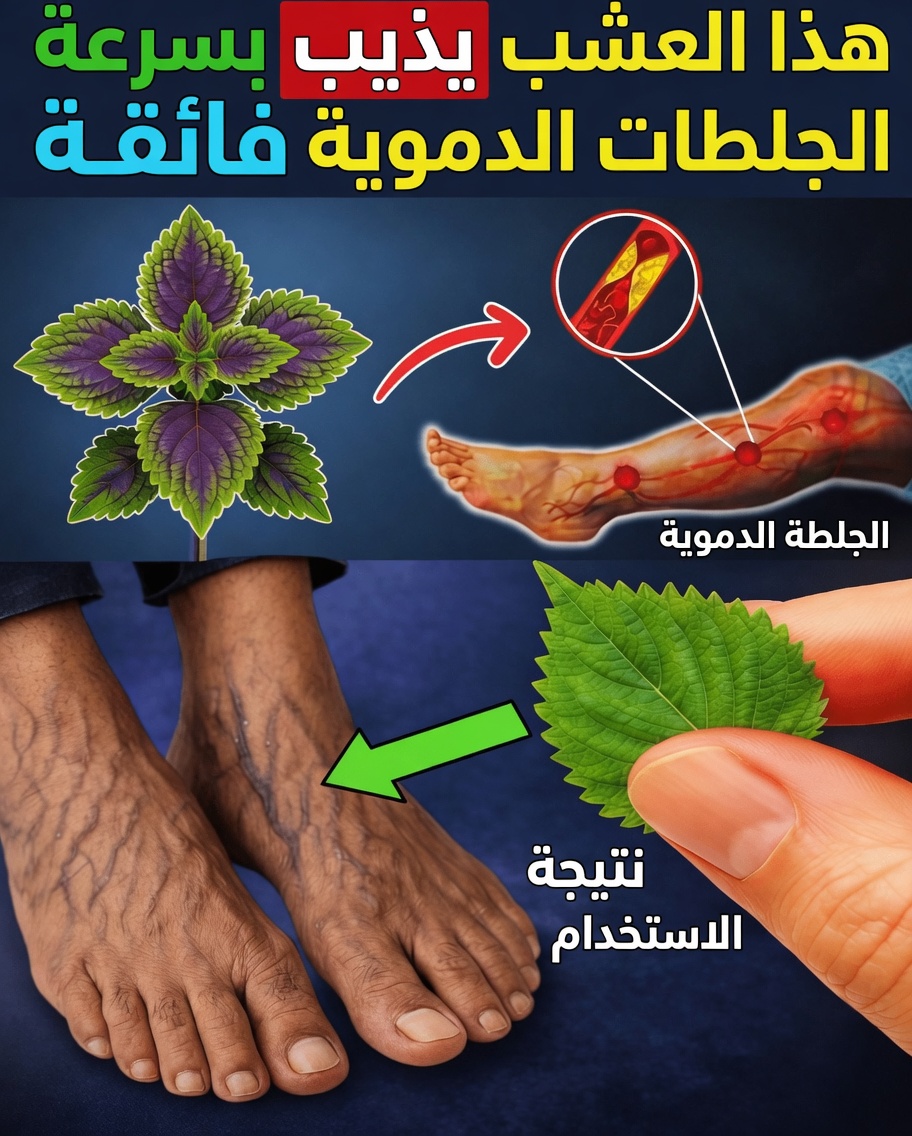 6 أعشاب قوية قد تساعد في دعم الدورة الدموية الصحية وتقليل خطر تجلط الدم بشكل طبيعي