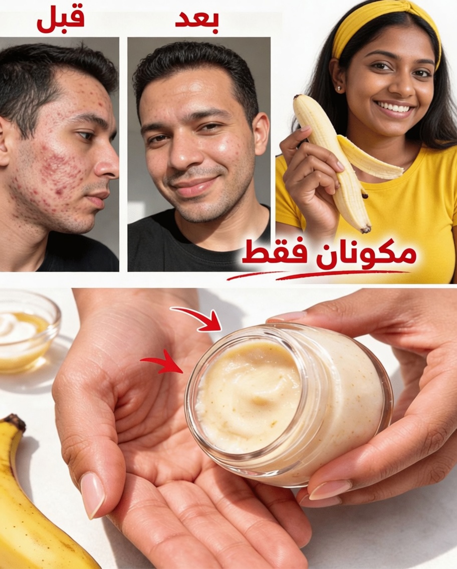 7 طرق طبيعية لتنعيم الخطوط الدقيقة وتعزيز إشراقة البشرة باستخدام قشور الموز