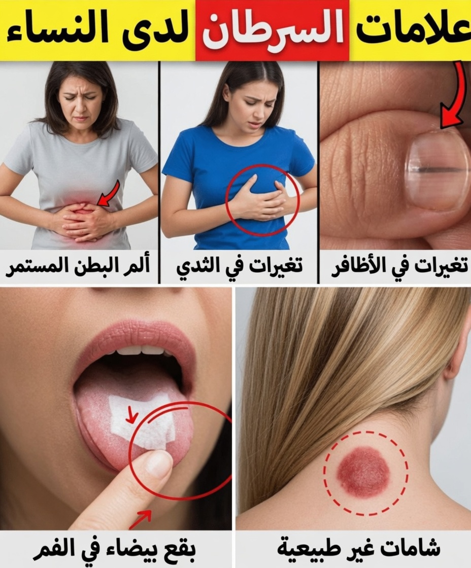 14 علامة تحذيرية للسرطان تتجاهلها كثير من النساء وما ينبغي لكل امرأة الانتباه إليه