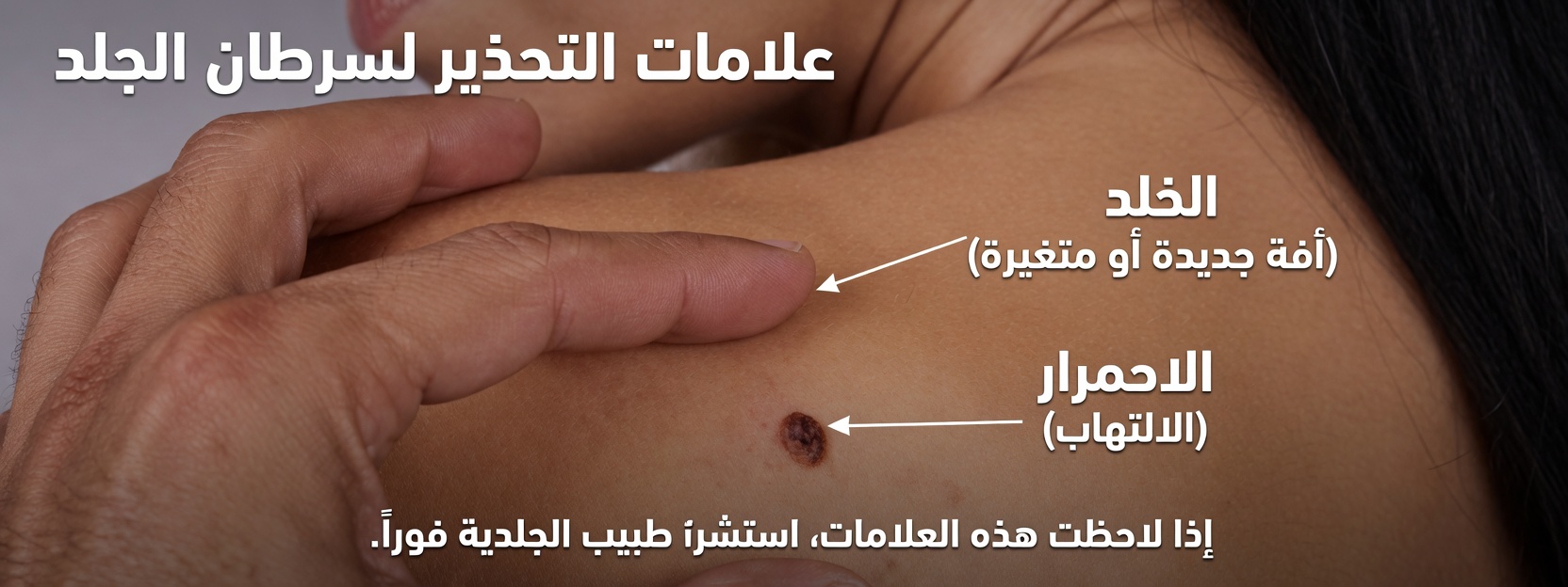14 علامة تحذيرية للسرطان تتجاهلها كثير من النساء وما ينبغي لكل امرأة الانتباه إليه