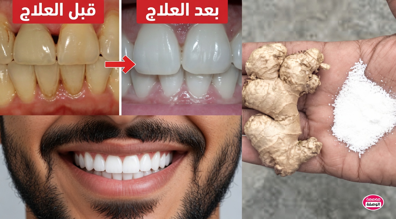 بيّض أسنانك فورًا بهذه الحيلة المكوّنة من الزنجبيل والملح خلال دقيقتين. إليك الطريقة