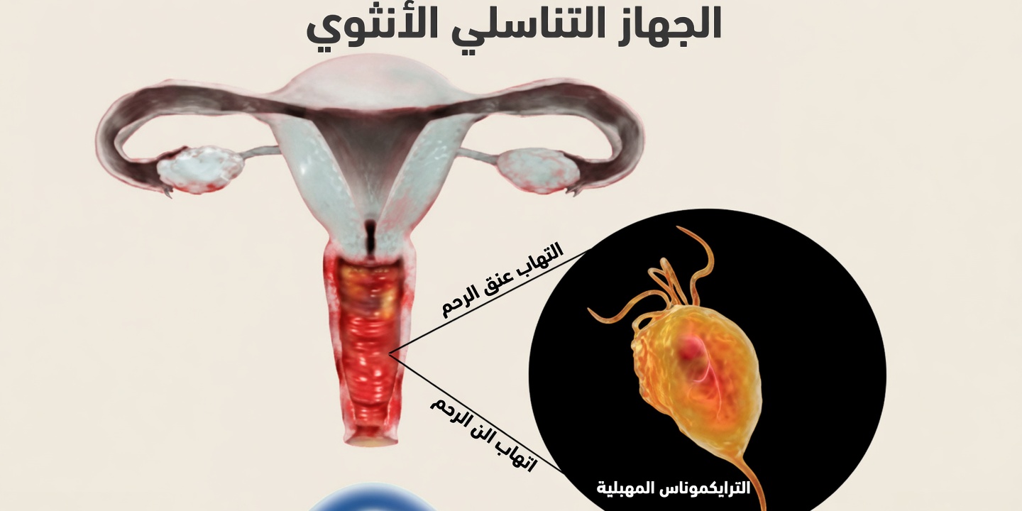 لماذا تعاني بعض النساء من رائحة سمكية في المنطقة الحساسة؟ أهم 5 أسباب ونصائح سهلة للوقاية