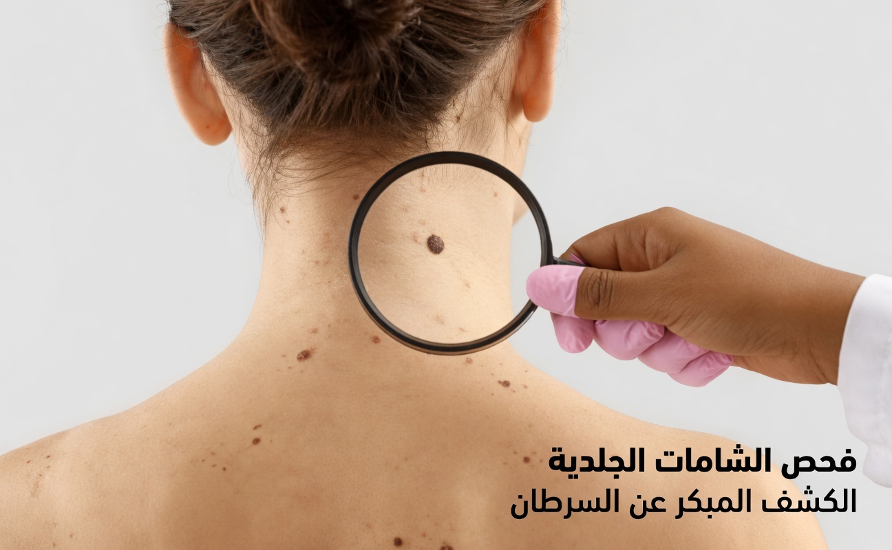 قل وداعًا للثآليل والزوائد الجلدية — الطريقة الطبيعية الفعّالة