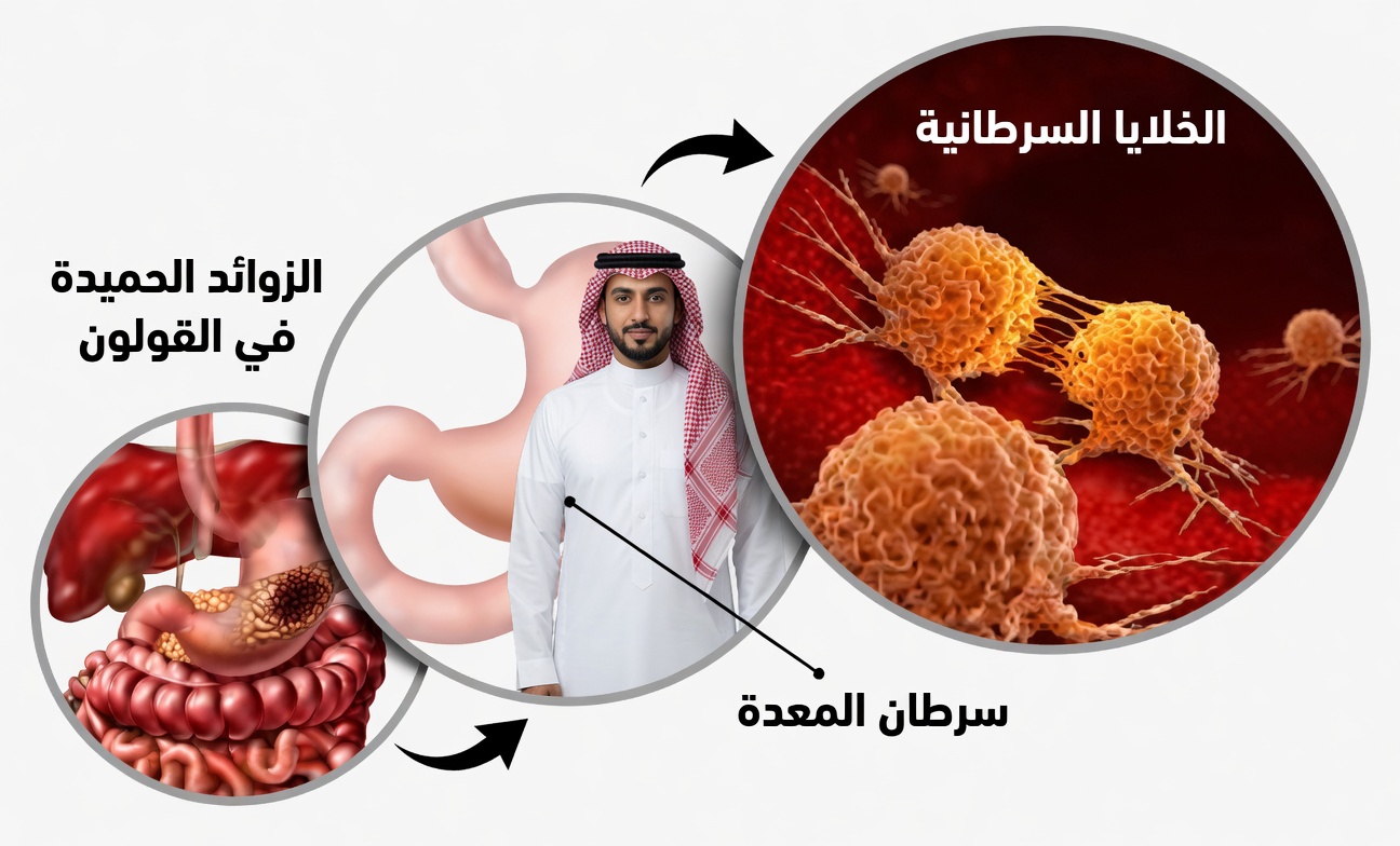 8 أعراض صادمة لسرطان البنكرياس لا يجب عليك تجاهلها أبداً | علامات الإنذار المبكر
