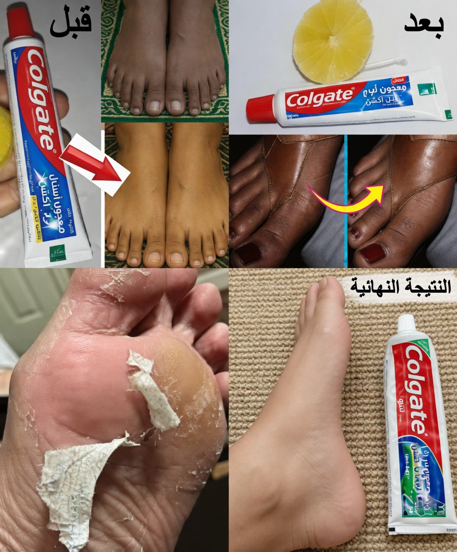 اكشف سر كولجيت للحصول على أقدام ناعمة كالحرير