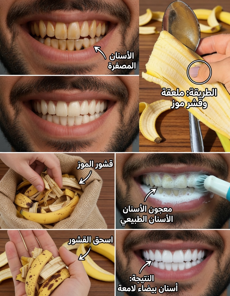 طرق طبيعية لتبييض الأسنان في المنزل: علاجات آمنة لابتسامة أكثر إشراقًا