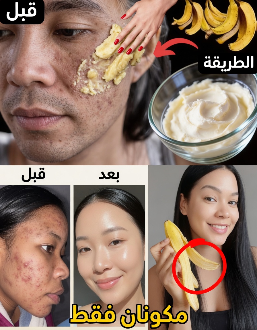 7 طرق طبيعية لتنعيم الخطوط الدقيقة وتعزيز إشراقة البشرة باستخدام قشور الموز