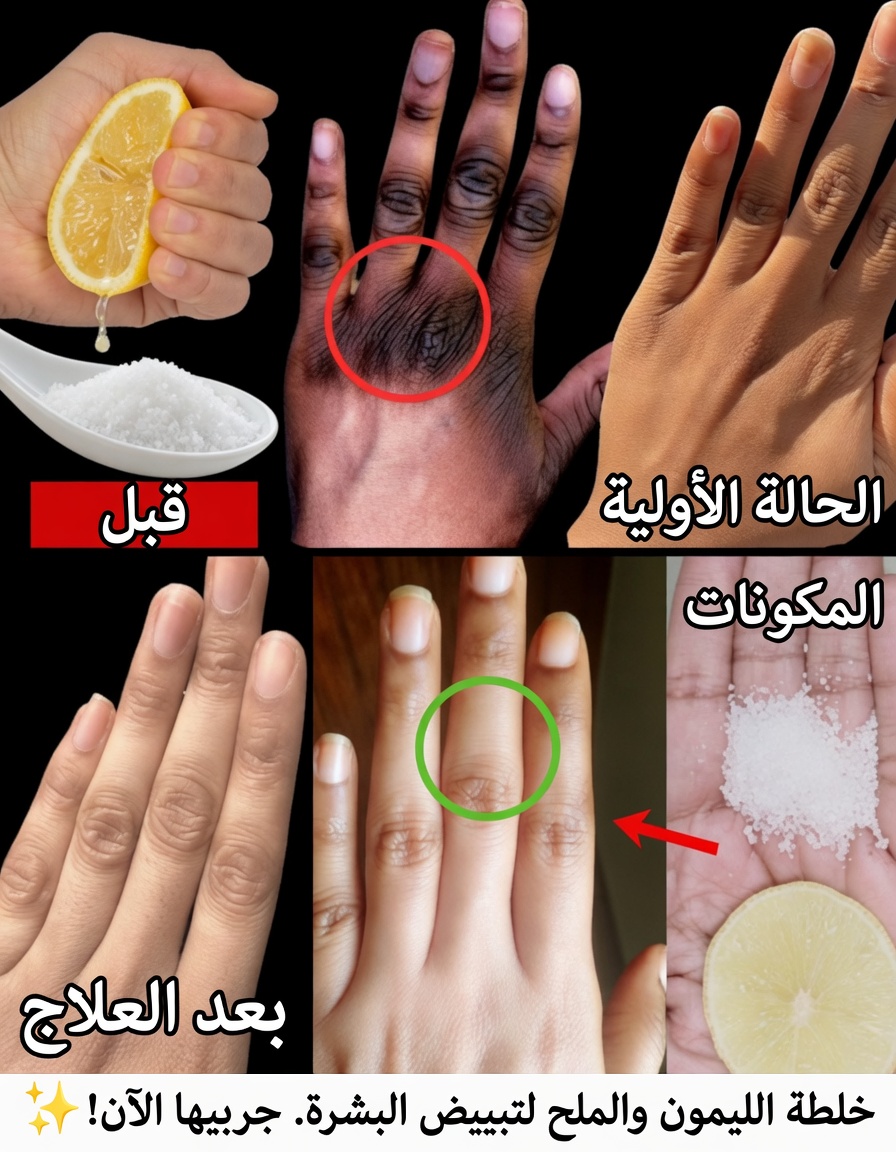 كيف أحافظ على يديّ ناعمتين وخاليتين من التجاعيد وملساء وأكثر شبابًا — قناع اليدين البسيط بالليمون + السكر + القهوة الذي ينجح فعلًا