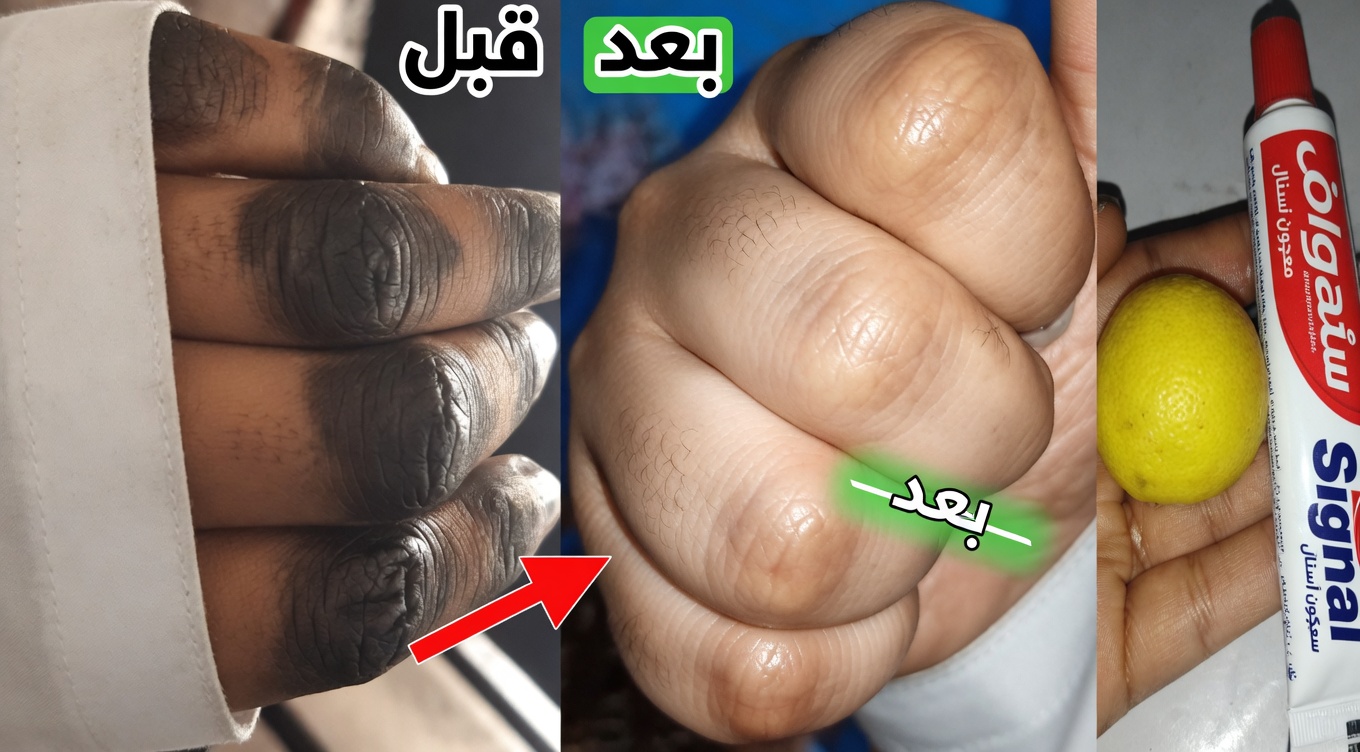كيف أحافظ على يديّ ناعمتين وخاليتين من التجاعيد وملساء وأكثر شبابًا — قناع اليدين البسيط بالليمون + السكر + القهوة الذي ينجح فعلًا