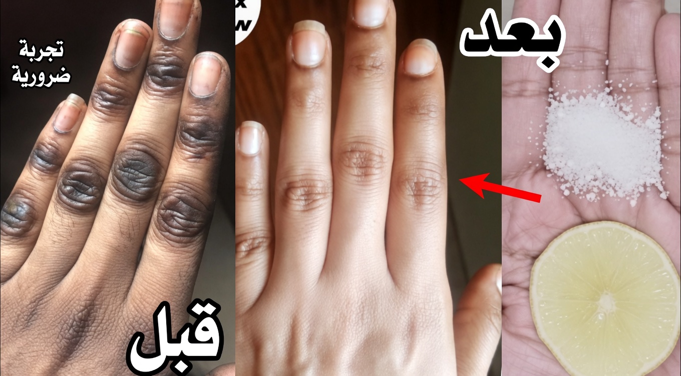 كيف أحافظ على يديّ ناعمتين وخاليتين من التجاعيد وملساء وأكثر شبابًا — قناع اليدين البسيط بالليمون + السكر + القهوة الذي ينجح فعلًا