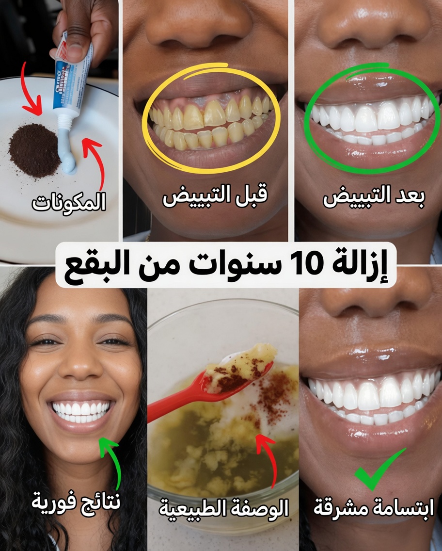 في دقيقتين فقط، تخلّص من بقع الأسنان المتراكمة منذ 10 سنوات – المُبيّض الطبيعي الذي يعمل بالفعل
