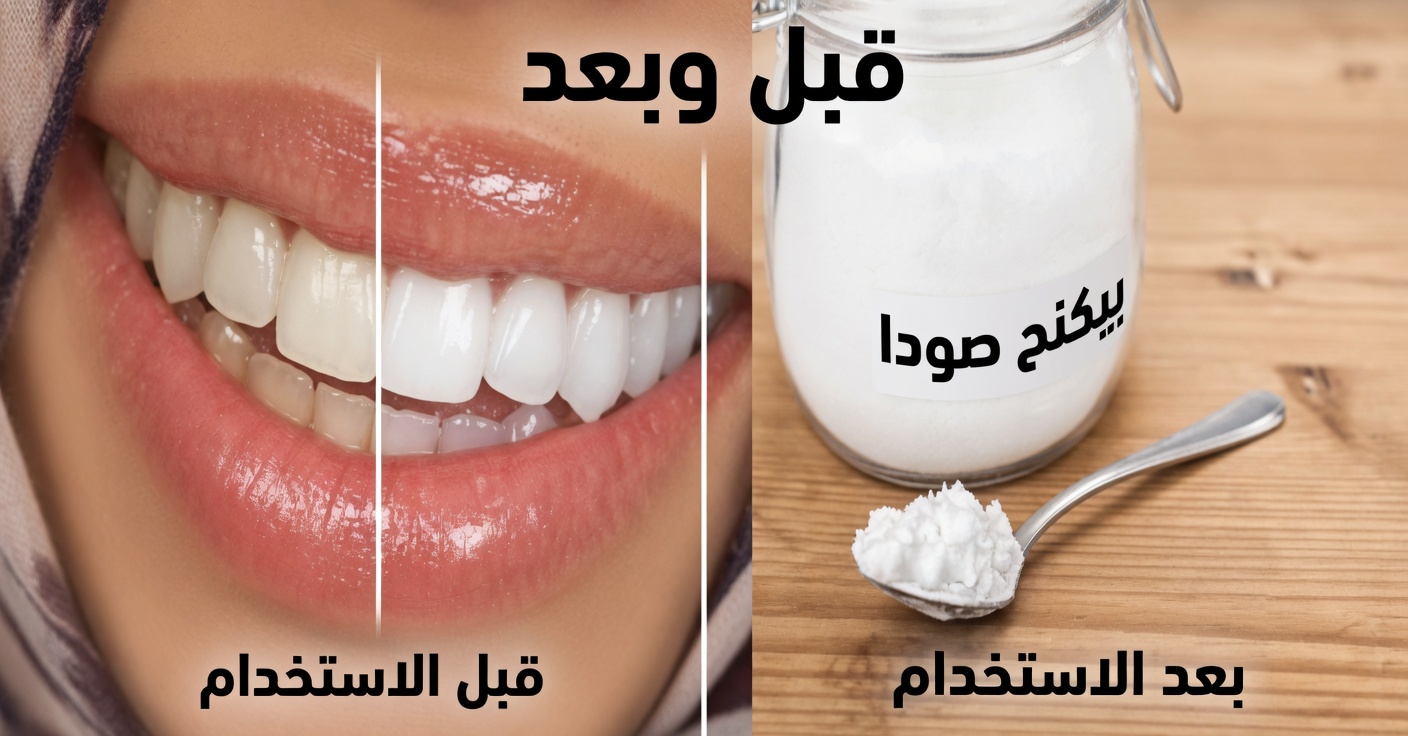 في دقيقتين فقط، تخلّص من بقع الأسنان المتراكمة منذ 10 سنوات – المُبيّض الطبيعي الذي يعمل بالفعل