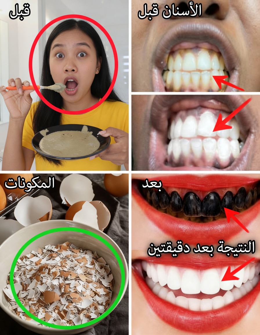 تبييض الأسنان بالبيض والقهوة: العلاج المنزلي الرائج الذي قد يفتّح الأسنان الصفراء – ما الذي ينجح حقًا وما الذي يجب الحذر منه