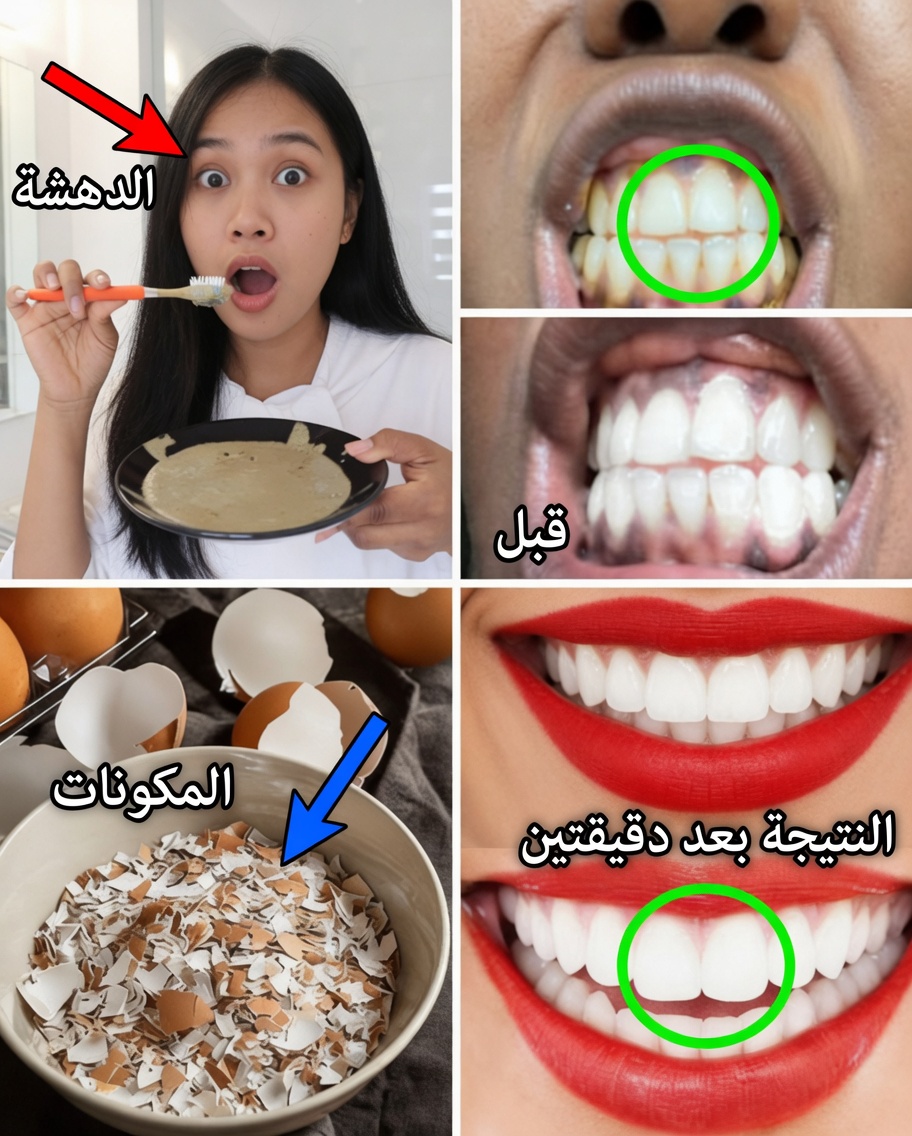في دقيقتين فقط، أزل 10 سنوات من تصبغات الأسنان – المبيّض الطبيعي الذي يعمل فعلاً