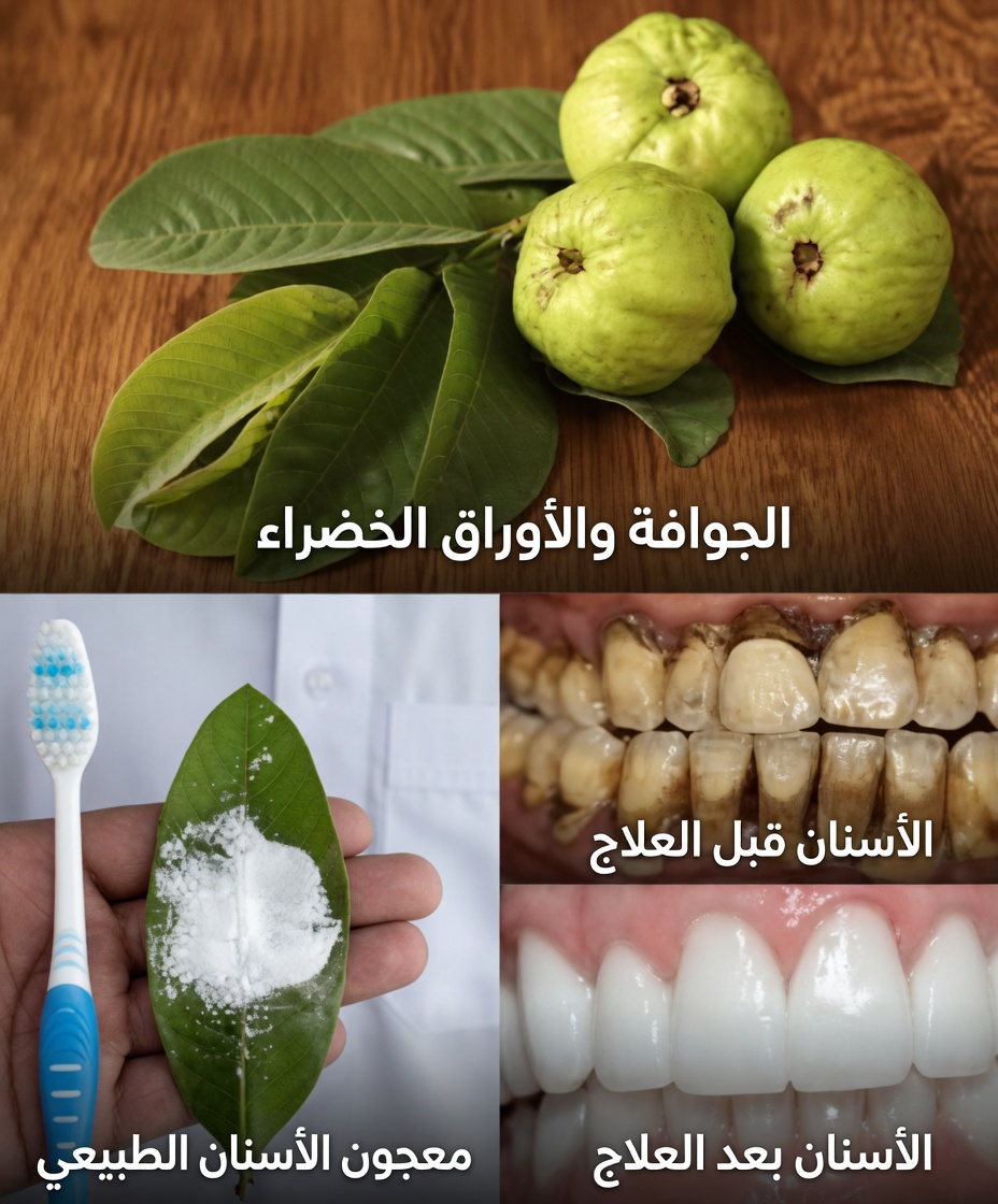 أفضل 3 طرق لعلاج تسوس الأسنان بأوراق الجوافة – بسيطة وموفرة للتكاليف