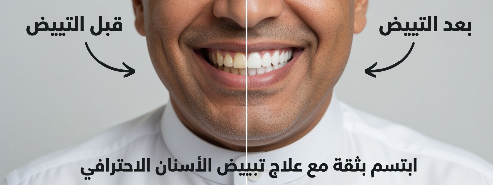 كيفية تفتيح ابتسامتك طبيعياً بأوراق الجوافة: علاج منزلي لطيف