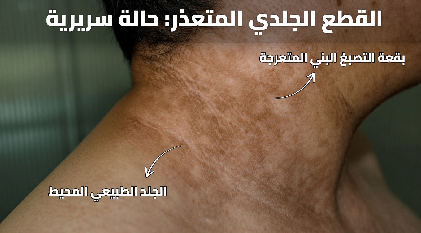 علامات الإنذار المبكر لمرض السكري التي لا يعرفها حتى معظم الأطباء