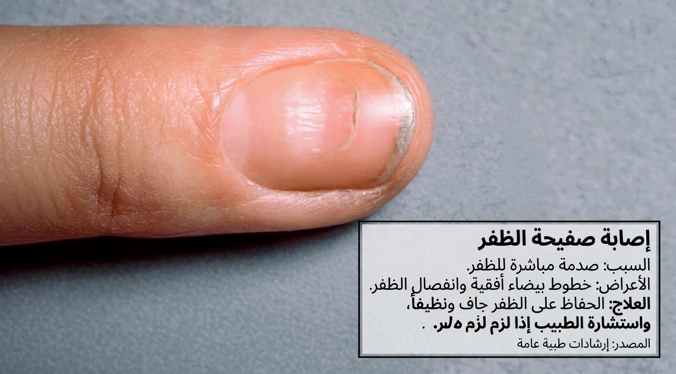 8 تغييرات غير ملحوظة في جسمك قد تكون تحذيرًا من مشكلات صحية