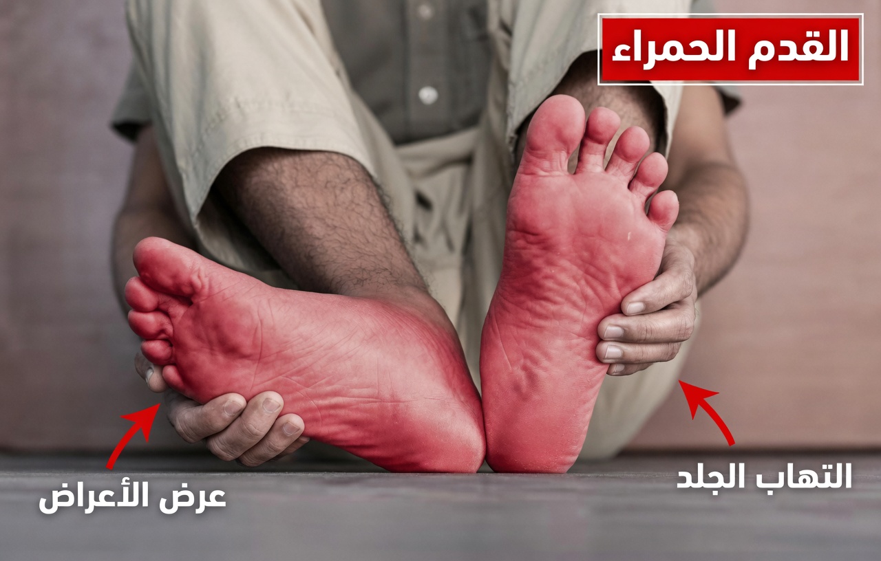 كبار السن انتبهوا: 15 طعامًا يزيد من الخدر والوخز في قدميك