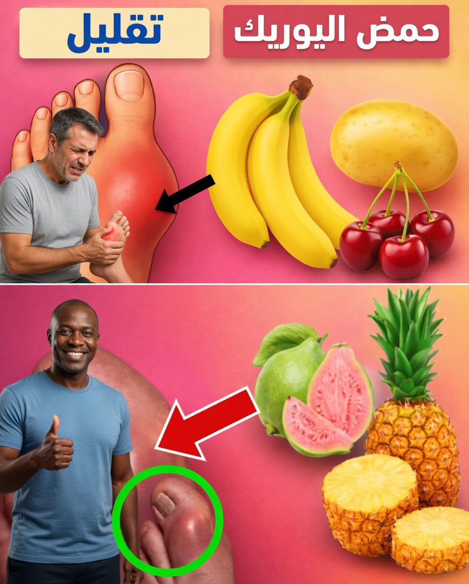 11 أطعمة مدعومة بالأبحاث قد تساعد على خفض مستويات حمض اليوريك لديك طبيعيًا