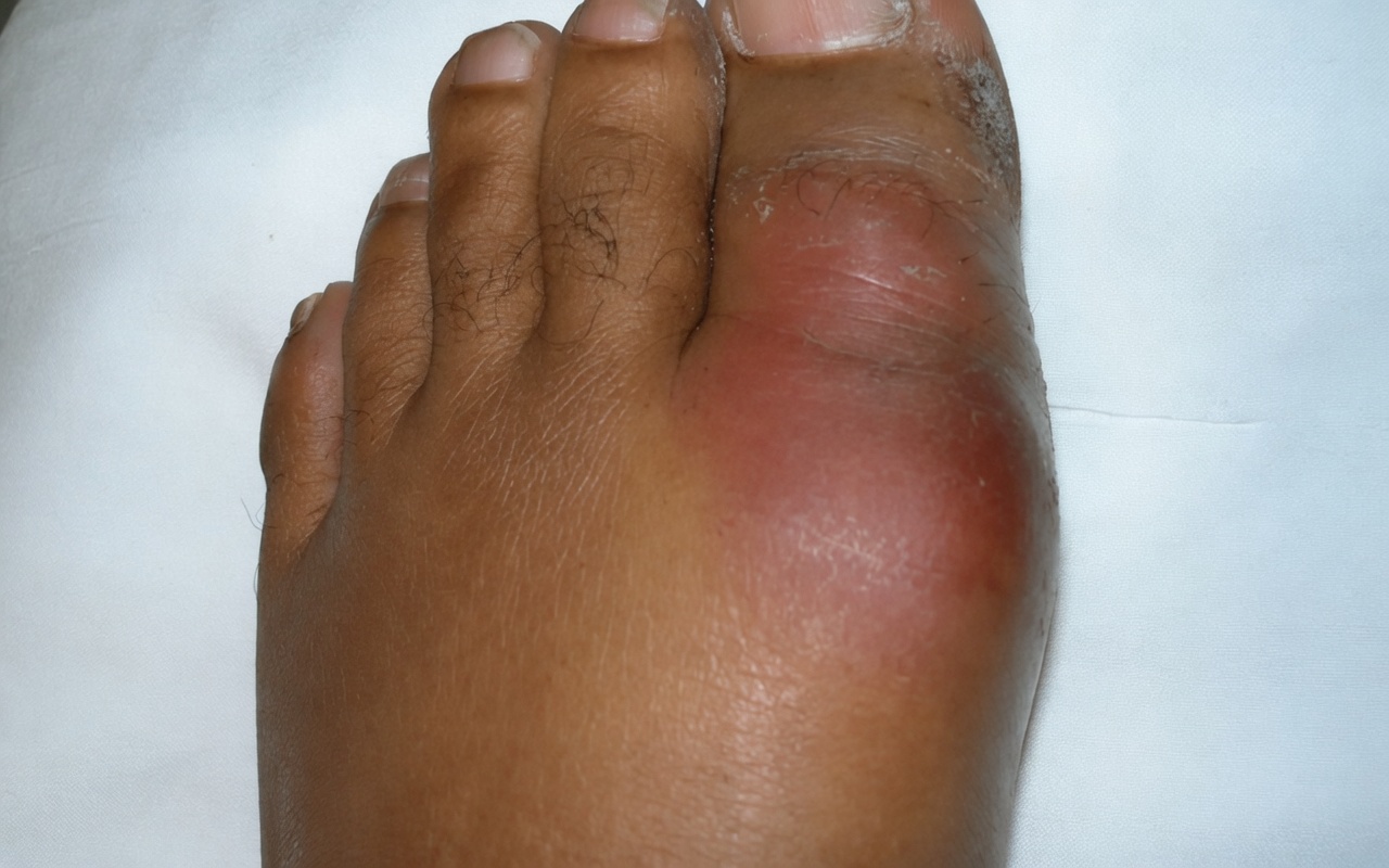 11 أطعمة مدعومة بالأبحاث قد تساعد على خفض مستويات حمض اليوريك لديك طبيعيًا