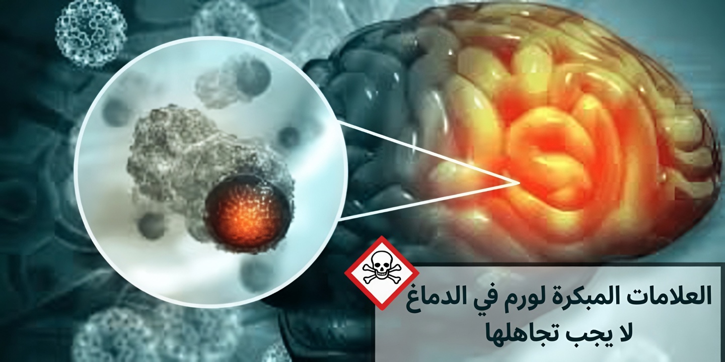 لا تفوّت هذه العلامات الثماني المبكرة لورم الدماغ – قد تنقذ حياتك!