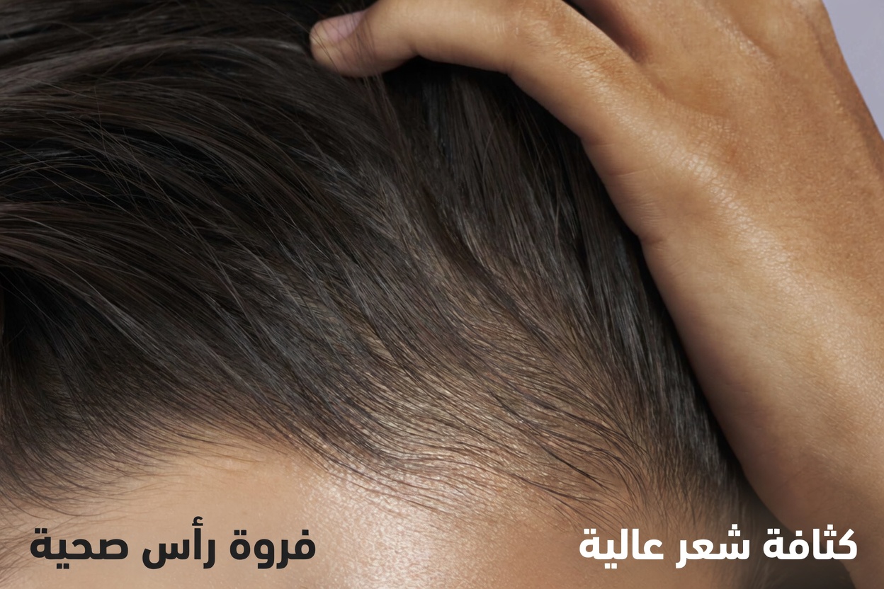 استخدم هذا مرتين أسبوعيًا وشاهد نموًا أسرع محتملًا للشعر – قوة الزنجبيل لصحة فروة الرأس وخصلات أكثر كثافة