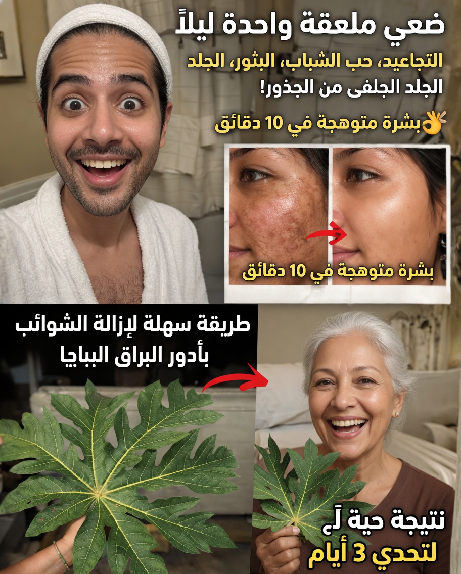 العلاج المفاجئ بأوراق البابايا الذي يساعد الآلاف على تخفيف الكلف والتصبغات وتغيّر لون البشرة طبيعيًا