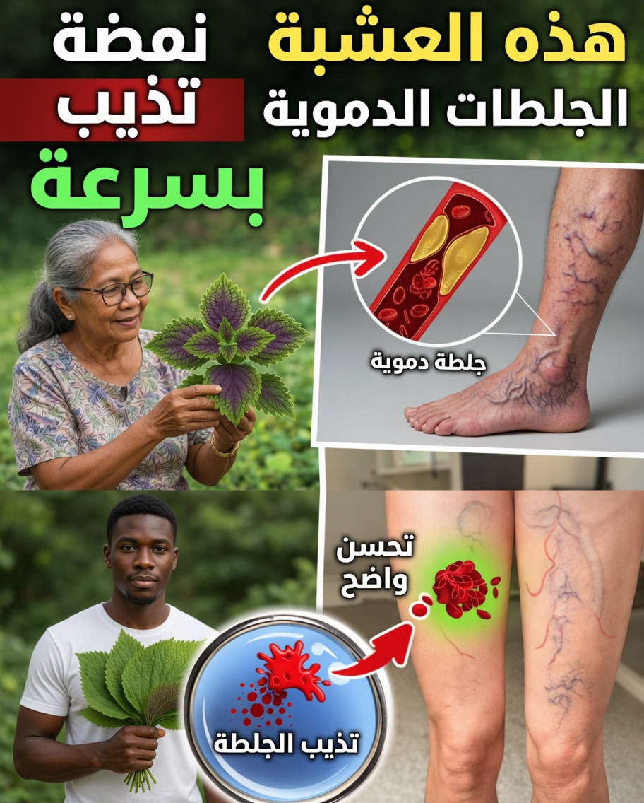 هل يُشير ثِقَل الساقين بعد الخمسين إلى مشكلات أكبر في الدورة الدموية؟ 6 أعشاب لاستكشافها