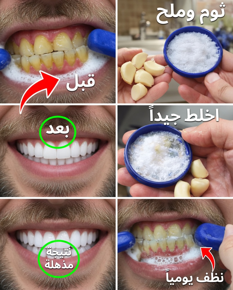 أضئ ابتسامتك بسرعة: حيل بسيطة لتبييض الأسنان في المنزل خلال دقائق