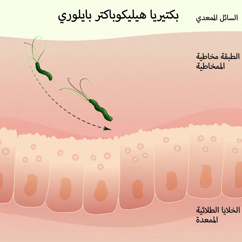 تحذير من الملوية البوابية: هل يمكن لهذه الجرثومة الصامتة في المعدة أن تؤثر عليك؟