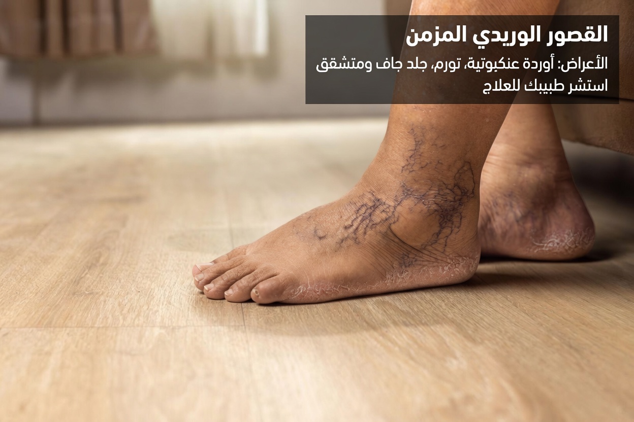 تحذير من الأملوديبين لكبار السن: 12 أثرًا جانبيًا خفيًا يفوتها كثيرون