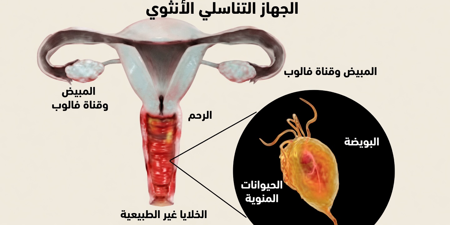 لماذا تكون رائحة المَهبل حامضة؟ 4 أسباب حقيقية يجب على كل امرأة معرفتها