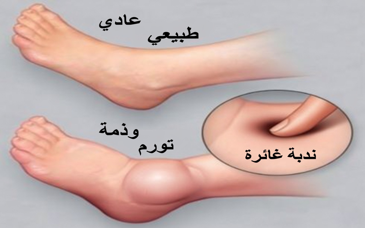 كيف تحذّرك قدماك من مشكلات الكبد: لا تفوّت هذه العلامات الخفية