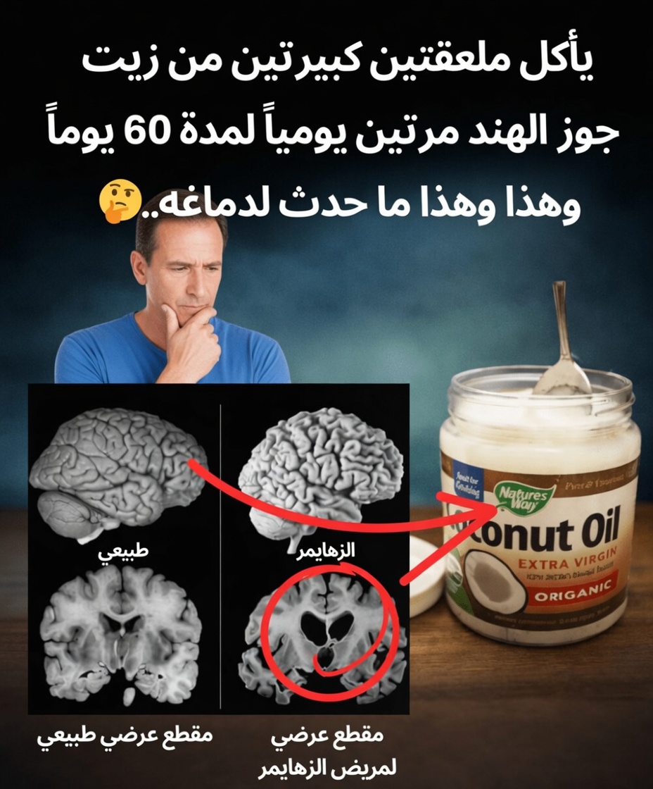 يتناول ملعقتين كبيرتين من زيت جوز الهند مرتين يوميًا لمدة 60 يومًا، وهذا ما يحدث لدماغه!