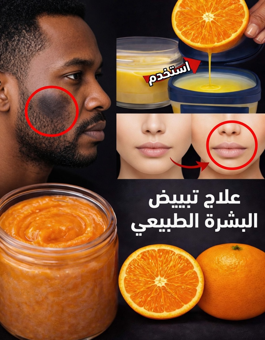 تحذير: هل تستخدم الفازلين والليمون بشكل خاطئ لبشرتك؟