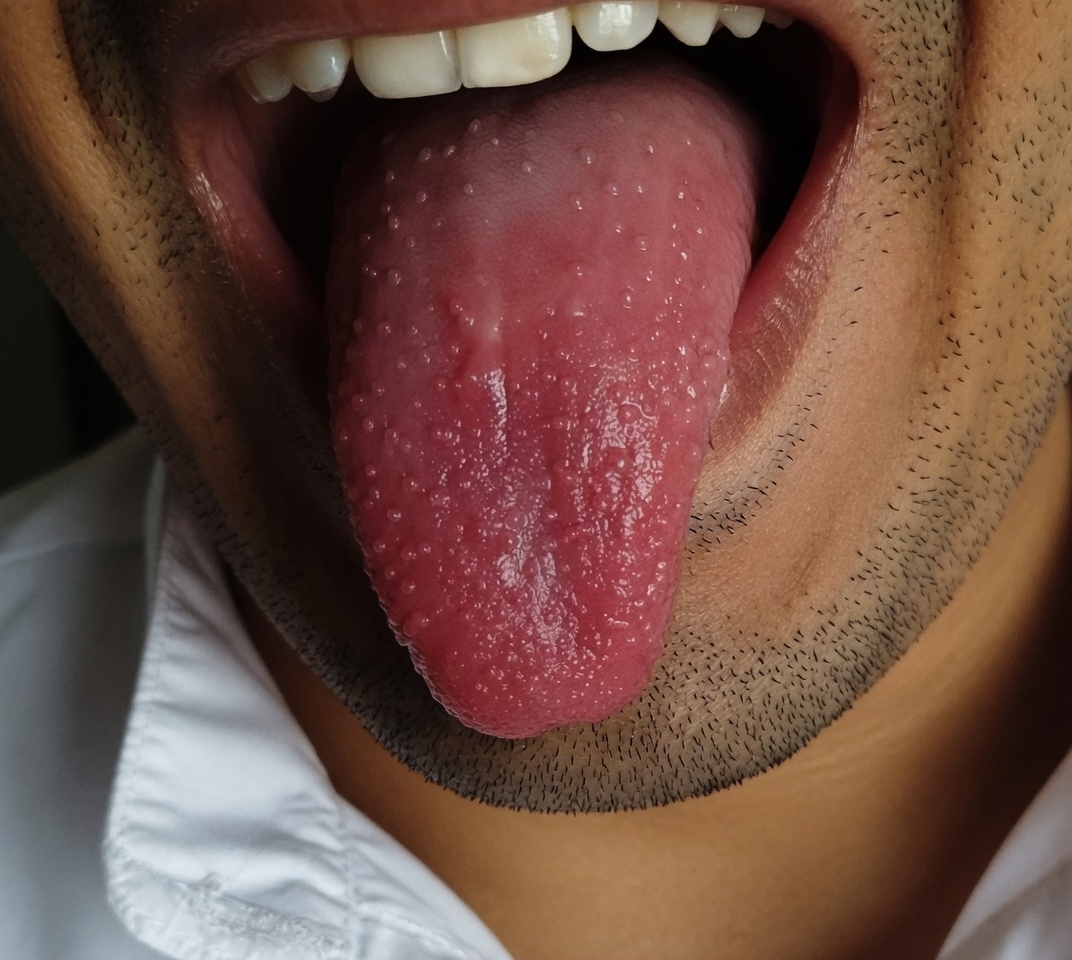 ماذا يكشف لون لسانك عن عاداتك الصحية
