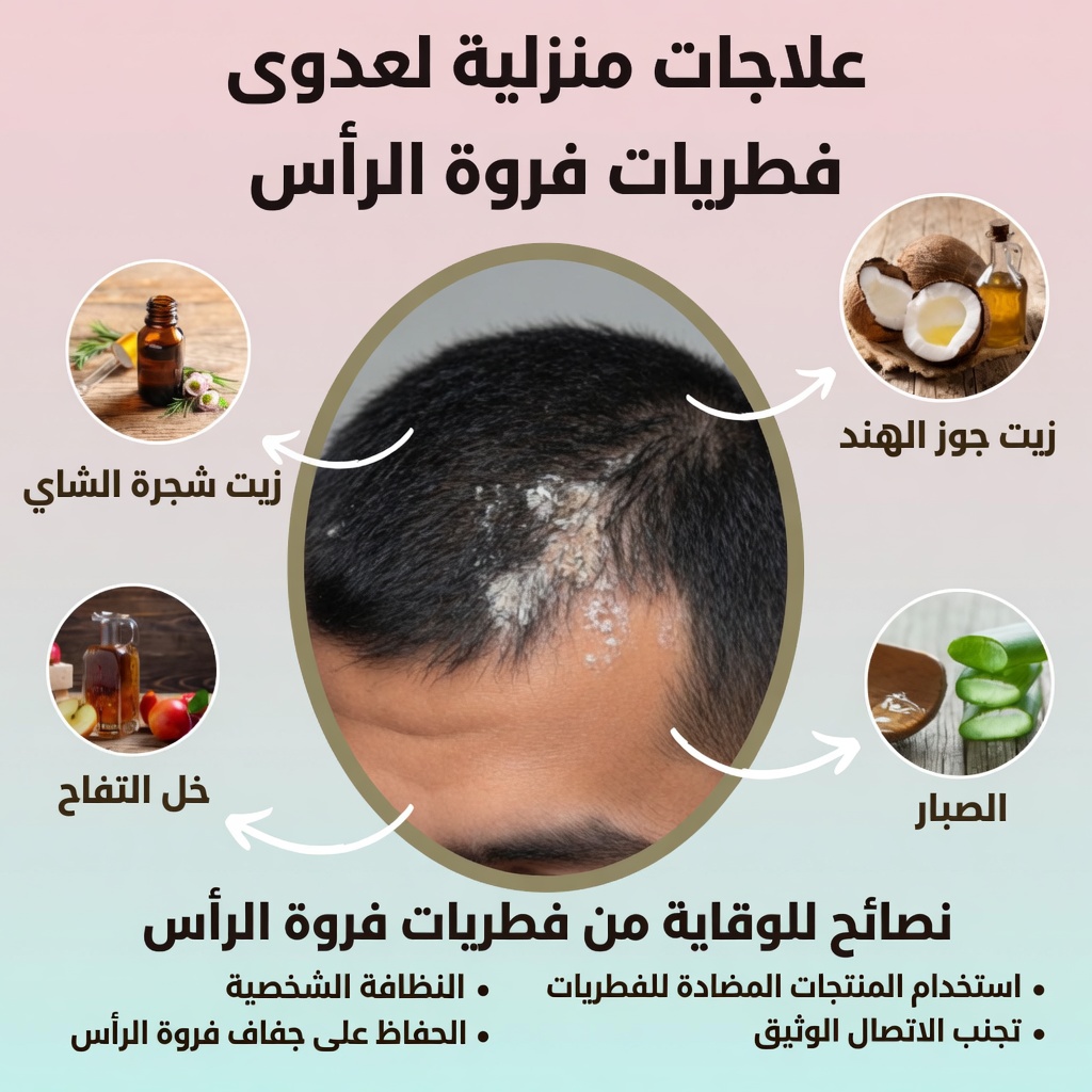 حلقات حمراء على فروة رأس طفلك مع تكسّر الشعر؟ إرشادات أساسية للوالدين