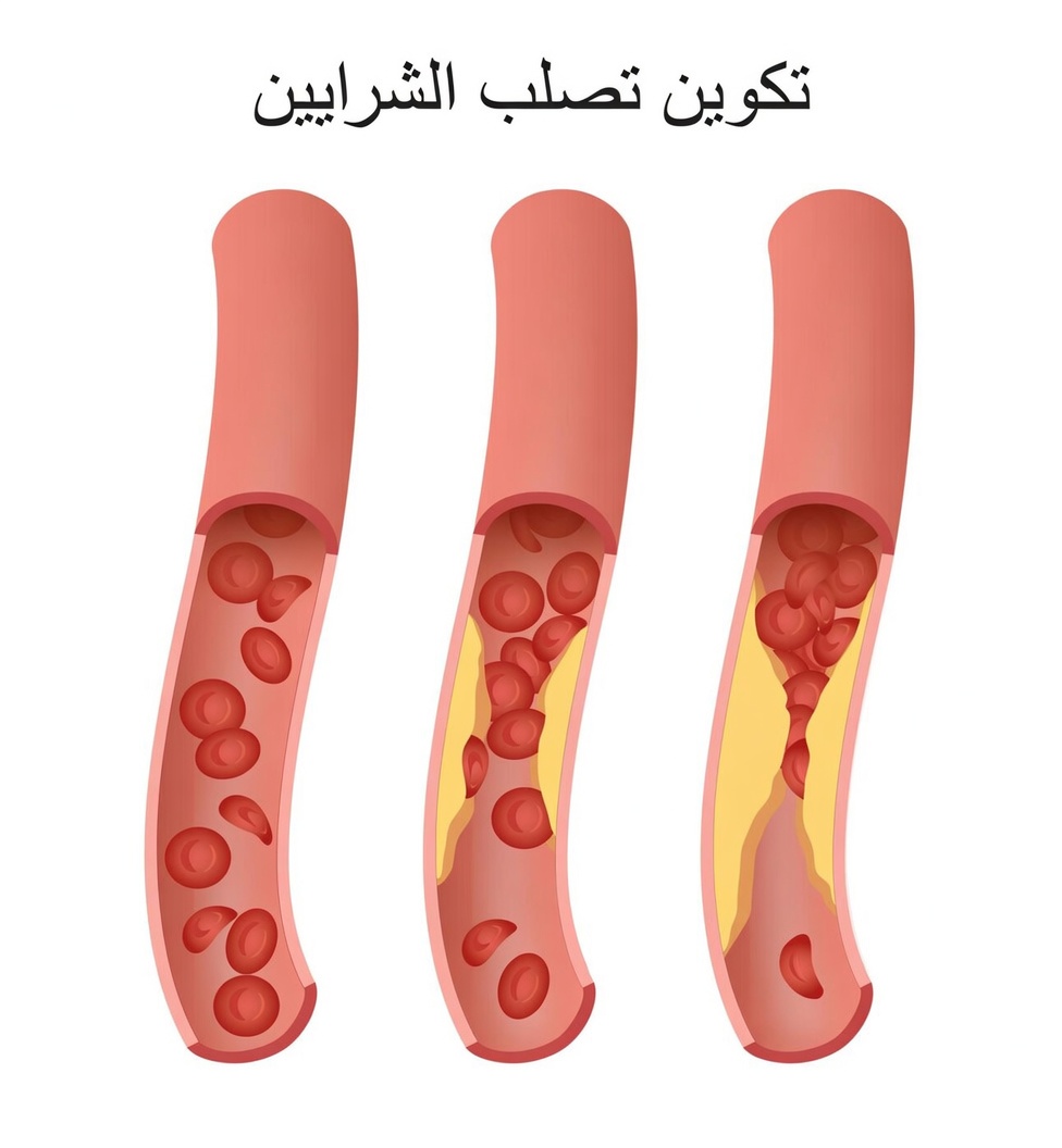 العادات الطبيعية والنصائح اليومية لدعم شرايين صحية