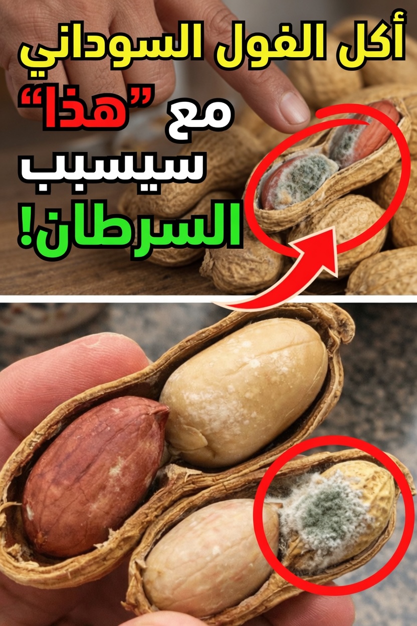 مقدمة: المخاطر الخفية للإفراط في تناول الفول السوداني