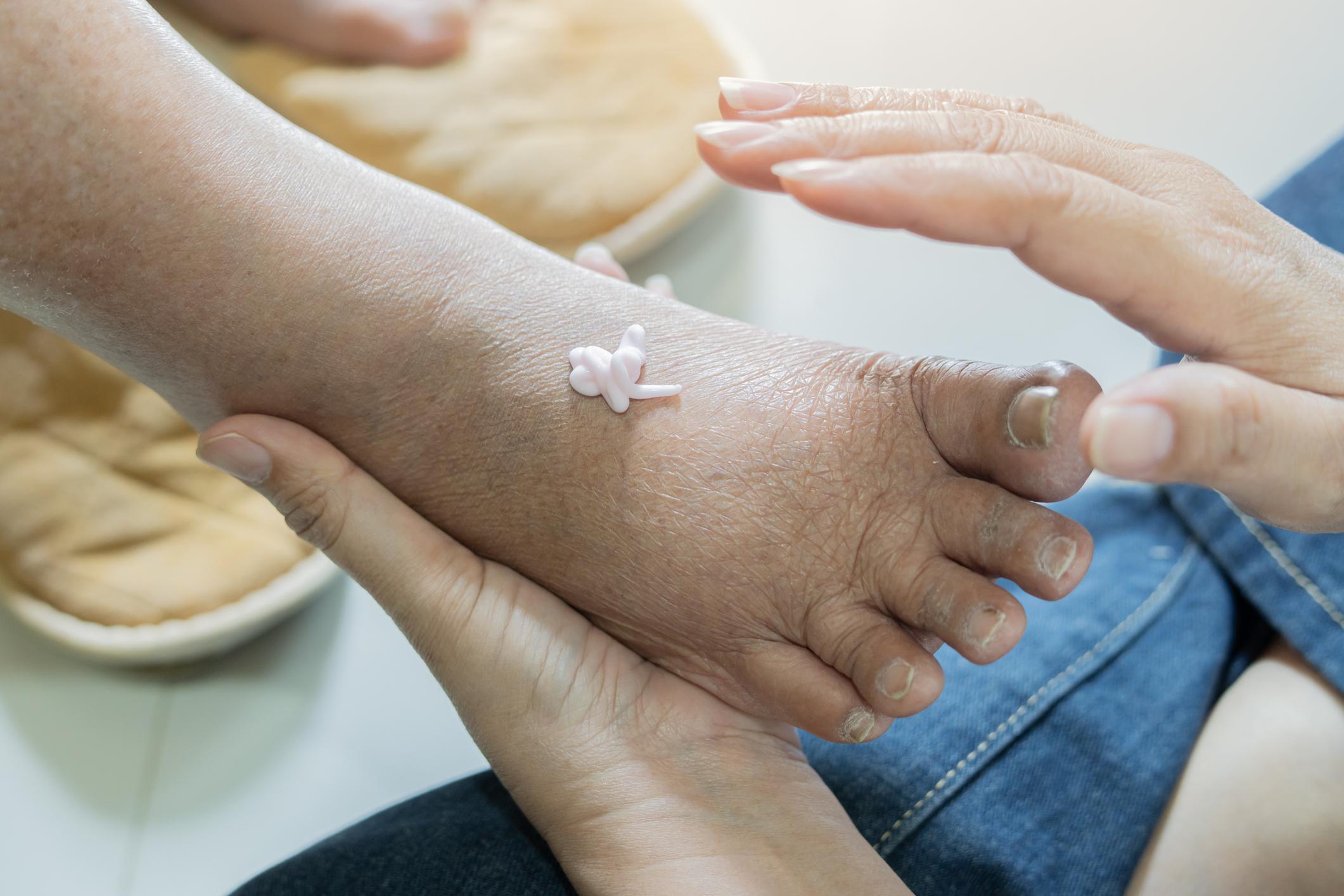 كبار السن: هل تعاني قدماك بصمت؟ جرّب هذا الروتين بخلّ التفاح