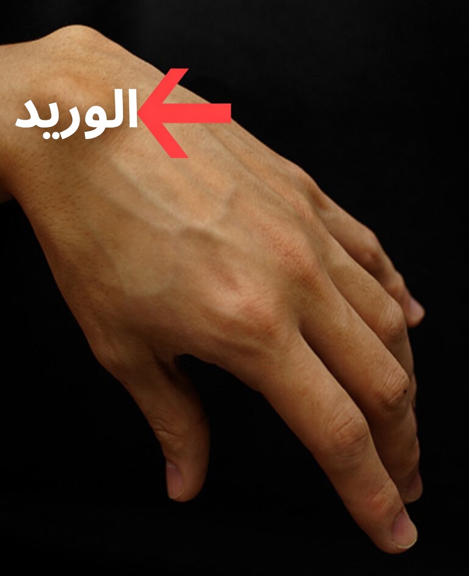 كتلة غريبة على المعصم بين ليلة وضحاها؟ ما الذي ينبغي لكبار السن معرفته