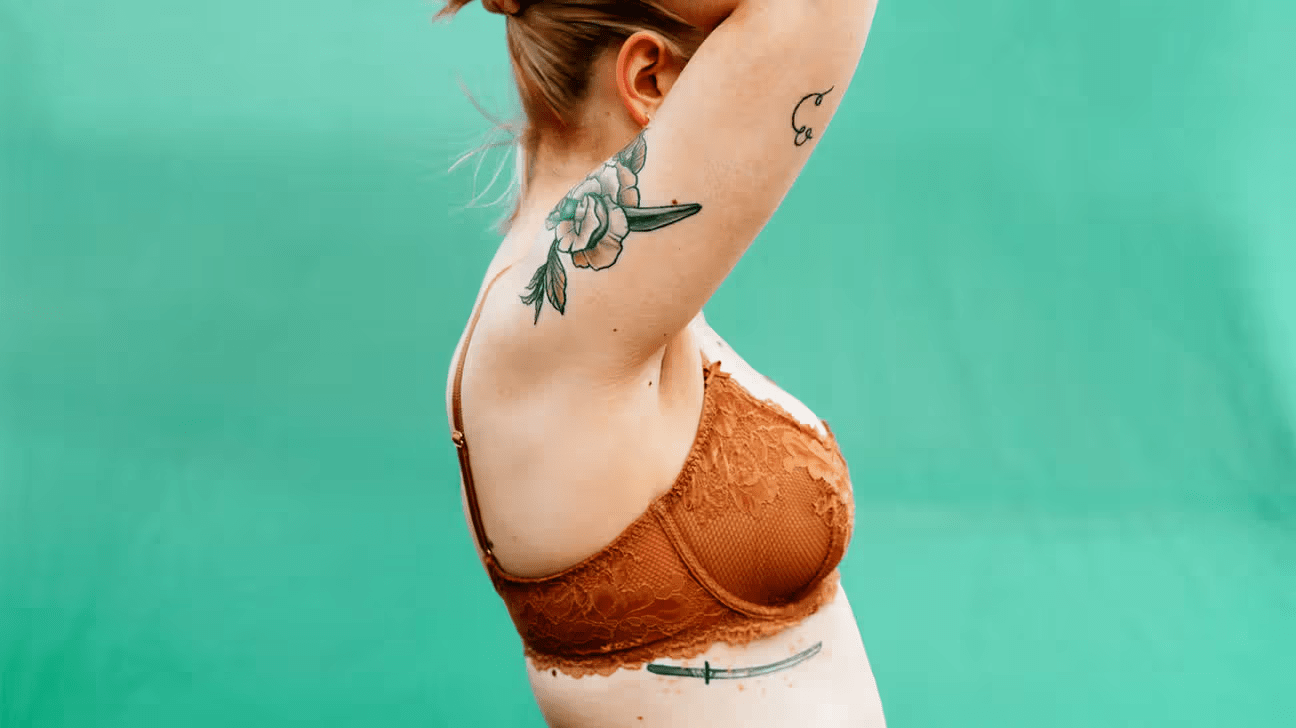 ماذا تفعلين حيال طفح جلدي مثير للحكة تحت ثدييكِ هذا الشتاء عندما لا يكون طبيبكِ متاحًا