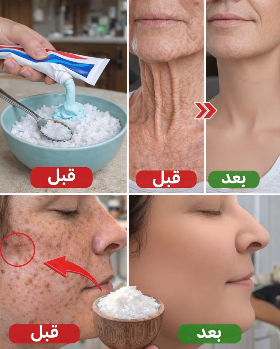 كيف اكتشفت مزيجًا بسيطًا من مكونات المطبخ لتقشير ساقيّ بلطف وتفتيحهما في المنزل