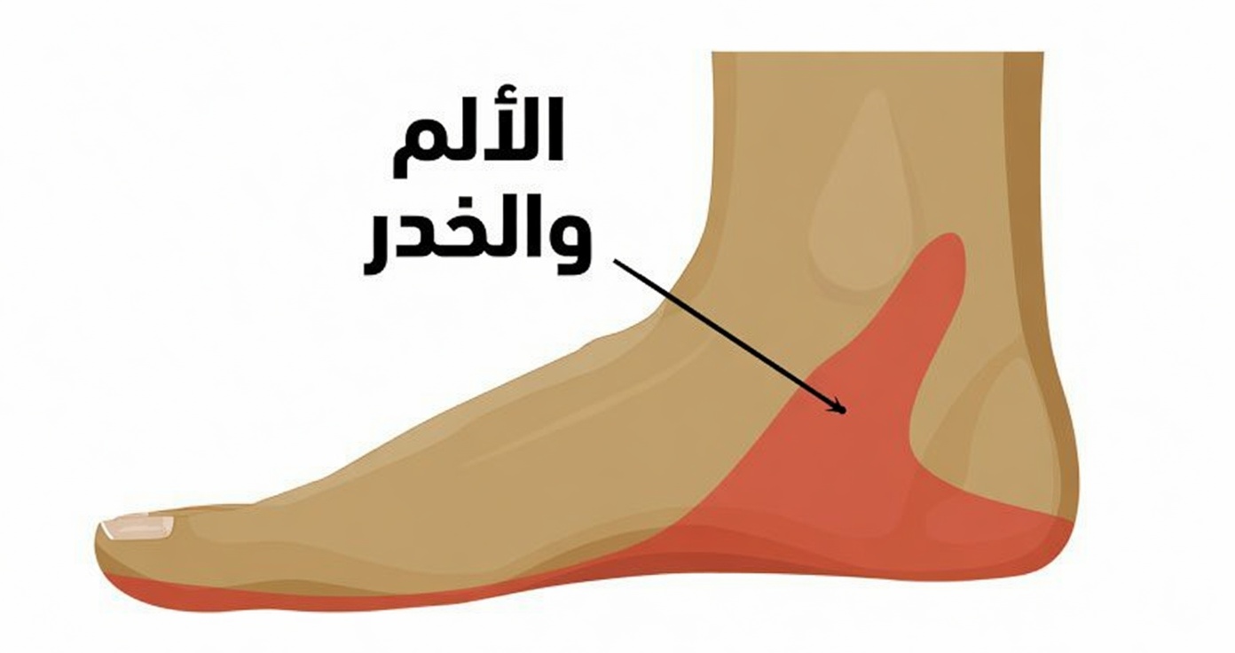 فهم خدر القدم وألمها: استكشاف 3 مشكلات صحية شائعة لا ينبغي تجاهلها