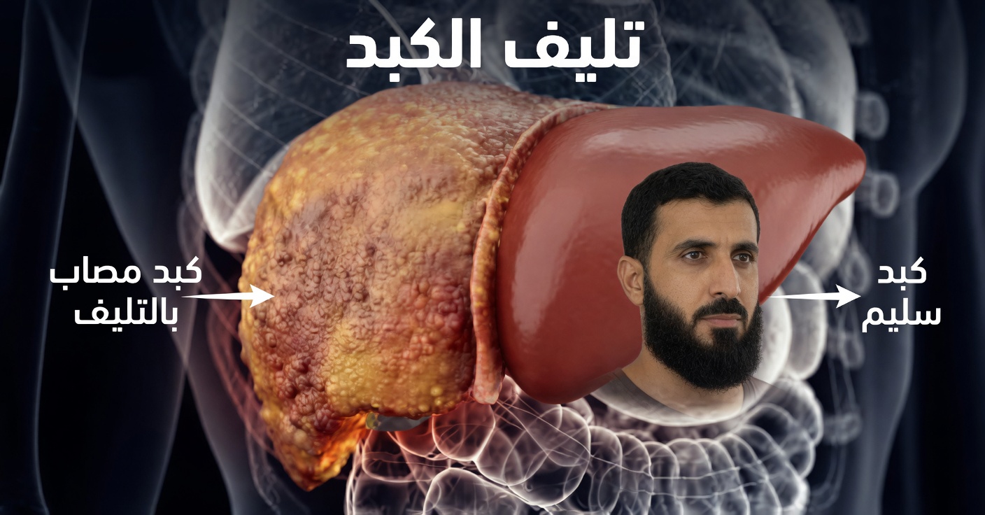 انكشف الأمر! هذا الطعام يدمّر كبدك (وأنت لا تدري)! العدو رقم 1 للكبد الدهني