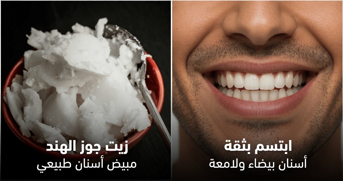 تبييض الأسنان في دقيقتين: سر قشر الموز الذي يصدم الجميع