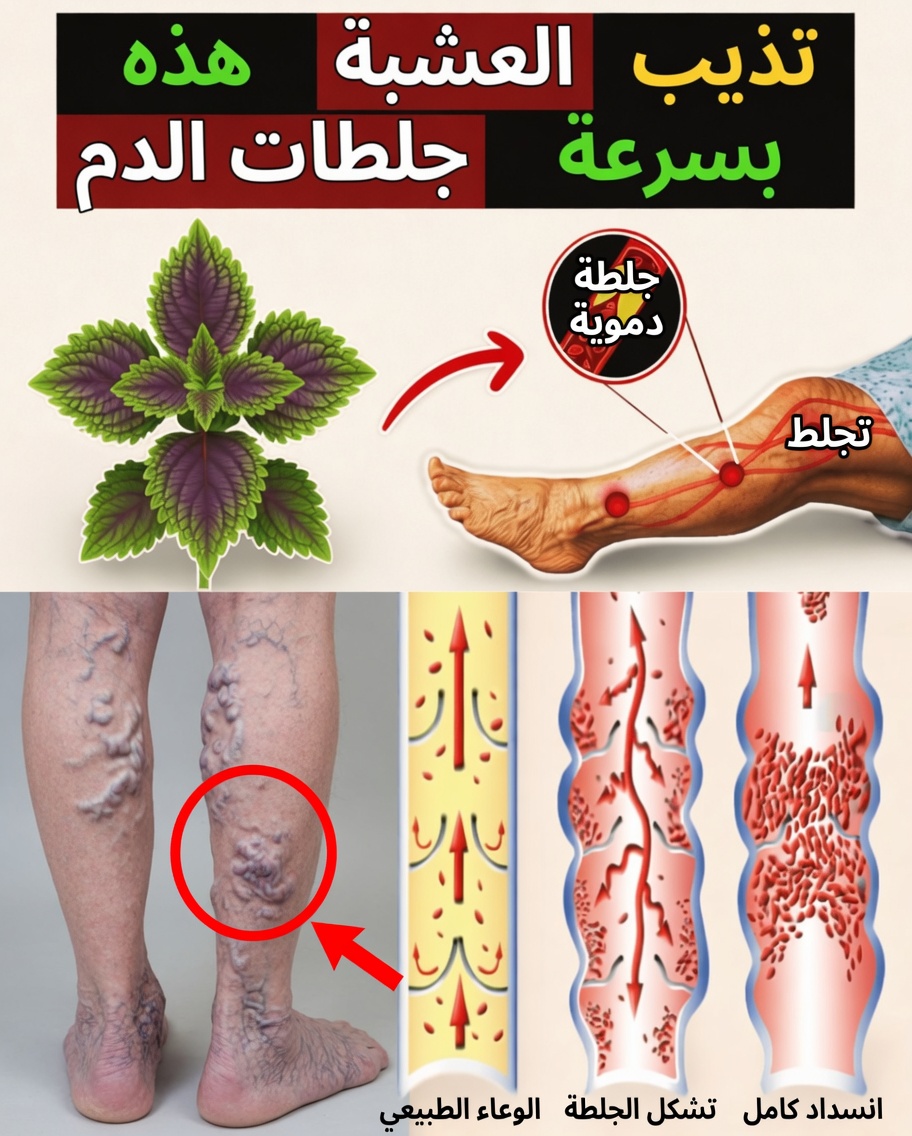 هل تجاوزت الستين؟ اكتشف 6 أعشاب طبيعية قد تدعم الدورة الدموية الصحية في الساقين بشكل طبيعي