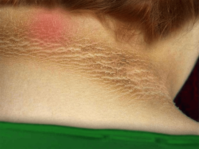 15 علامة تحذيرية مبكرة لمرض السكري يجب أن تتعرف عليها لتعزيز الوعي الصحي